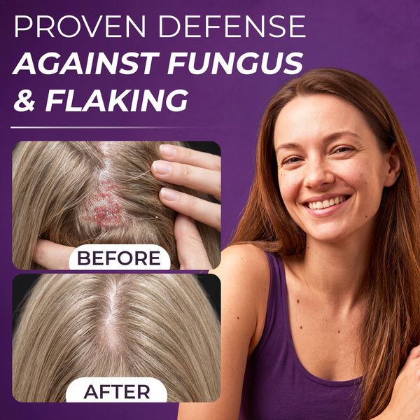 Neoketramin Scalp Scrub