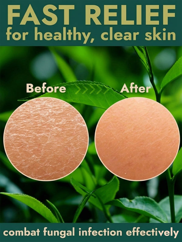 Antifungal Pumice Soap