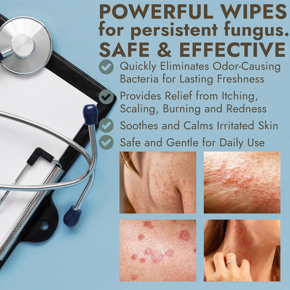 Antifungal Body Powder