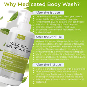 Folliculitis Body Wash