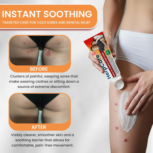 Herpes Genital Treatment | Herpcare Fast Acting Ointment | Can be Used on Cold Sore | Homeopathic Medicine | Soothes Itching, Tingling & Burning | Relief from The Symptoms of Genital Sore (Pack of 3)
