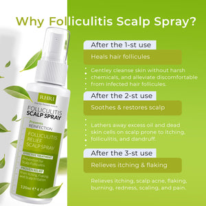 Folliculitis Shampoo | Antifungal Shampoo for Seborrheic Dermatitis, Scalp Psoriasis & Dandruff | Soothes Itchy, Dry Scalp | Cleanses, Exfoliates & Removes Build-Up | Reactivates Hair Follicles