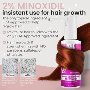 2% Minoxidil for Women Hair Regrowth Spray