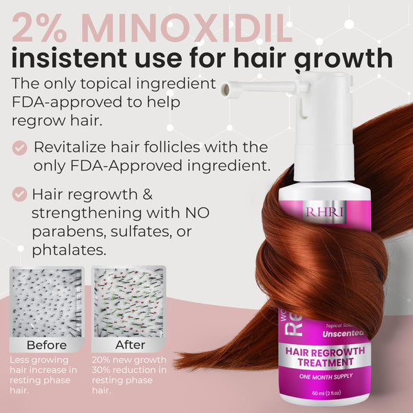 2% Minoxidil for Women Hair Regrowth Spray