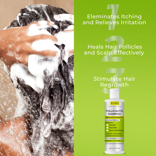 Folliculitis Shampoo | Antifungal Shampoo for Seborrheic Dermatitis, Scalp Psoriasis & Dandruff | Soothes Itchy, Dry Scalp | Cleanses, Exfoliates & Removes Build-Up | Reactivates Hair Follicles