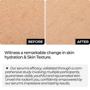 Anti Wrinkle Matrixyl 3000 Hyaluronic Acid Serum for Face | Collagen Serum | Anti-Aging & Hydrating for Deep Wrinkle Repair | Face Tightening & Firming Serum for Fine Lines & Forehead Wrinkles