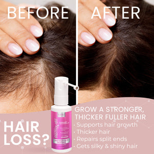 2% Minoxidil for Women Hair Regrowth Spray