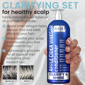 Hydrating Shampoo & Conditioner Set for Dry, Damaged & Fine Hair | Strengthen Hair Roots for Thicker, Stronger Hair, Nourishes Scalp, Reduces Breakage