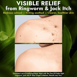Antifungal Body Wash with Tea Tree Oil