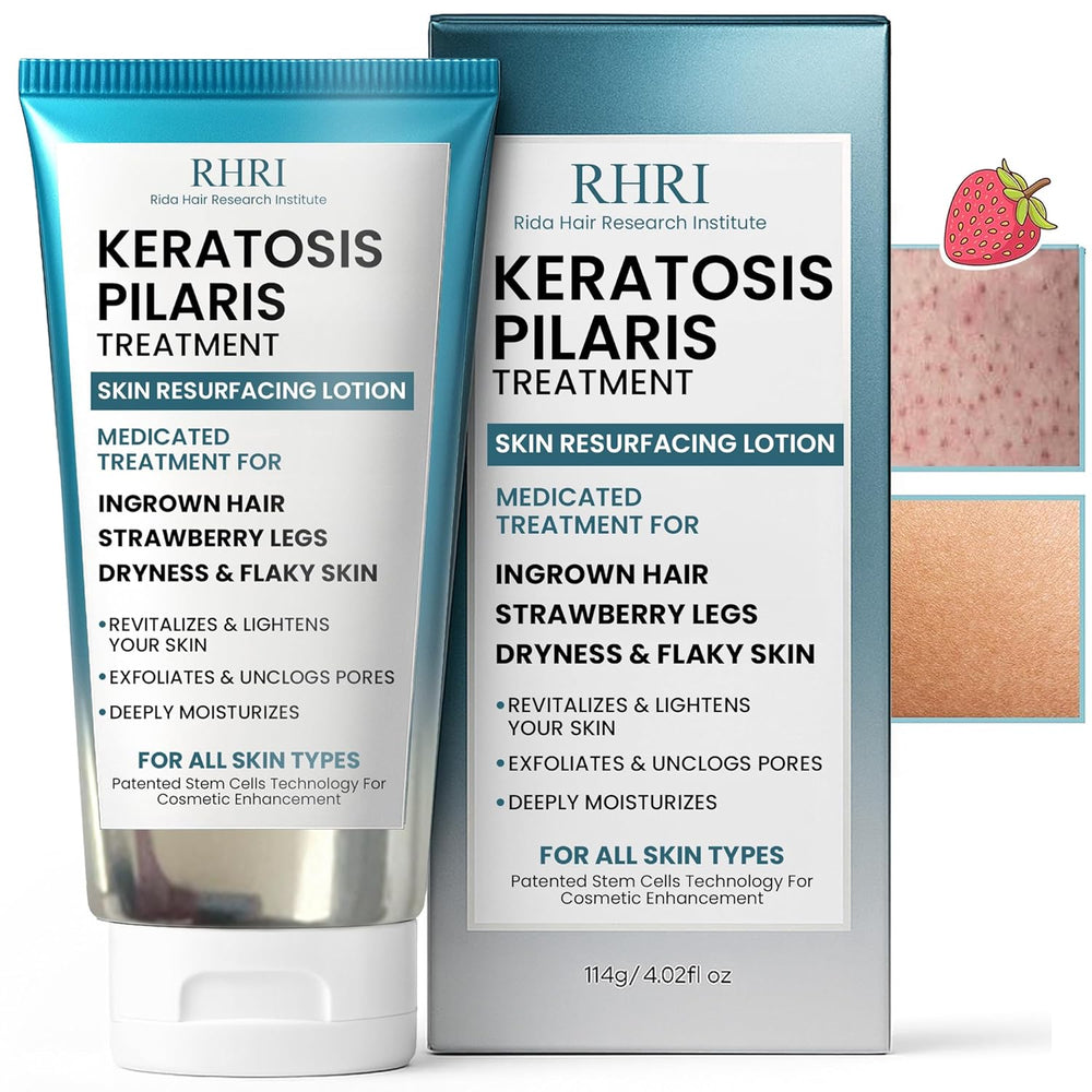 Keratosis Pilaris Treatment