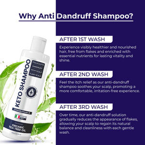 Pharmlitalia Scalp Psoriasis Shampoo, Flakes Shampoo Anti Dandruff, Itchy Scalp Treatment for Seborrheic Dermatitis & Folliculitis, Anti Fungal, Medicated Solution for Itchy, Flaky & Dry Hairs