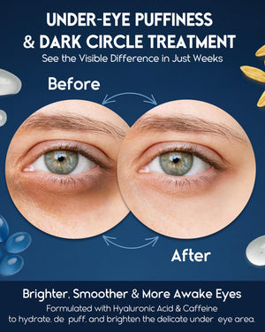 Under Eye Cream