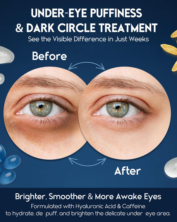 Under Eye Cream