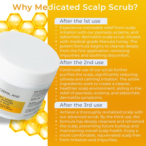 Scalp Scrub for Psoriasis