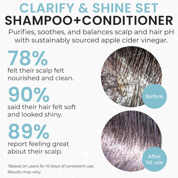 Hydrating Shampoo & Conditioner Set for Dry, Damaged & Fine Hair | Strengthen Hair Roots for Thicker, Stronger Hair, Nourishes Scalp, Reduces Breakage