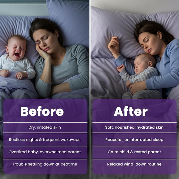 Magnesium Lotion for Kids