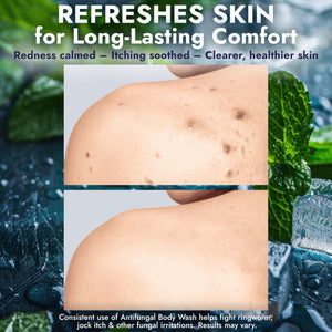 Terramed Just Think Comfort Antifungal Body Wash