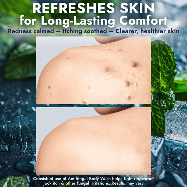 Terramed Just Think Comfort Antifungal Body Wash
