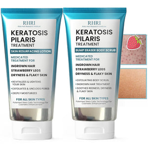 Keratosis Pilaris Treatment