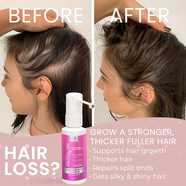 2% Minoxidil for Women Hair Regrowth Spray