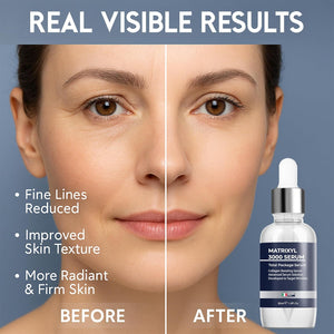 Anti Wrinkle Matrixyl 3000 Hyaluronic Acid Serum