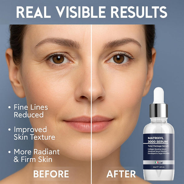 Anti Wrinkle Matrixyl 3000 Hyaluronic Acid Serum