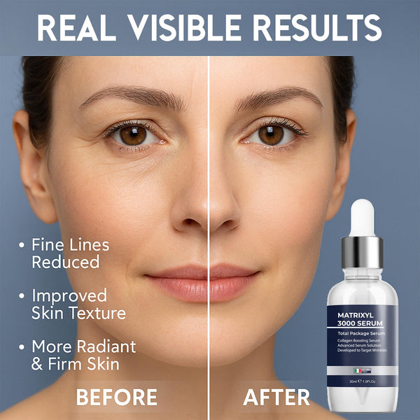 Matrixyl 3000 Hyaluronic Acid Serum for Face
