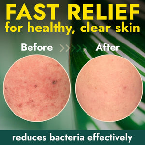 Antibacterial Body Wash with Tea Tree Oil