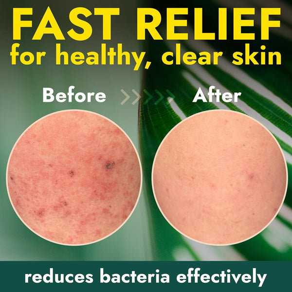 Antibacterial Body Wash with Tea Tree Oil