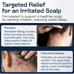 Pharmlitalia Psoriasis Shampoo for Dry & Itchy Scalp with Salicylic Acid 3% - Psoriasis Scalp Treatment for Eczema Relief, Seborrheic Dermatitis, Ringworm & Folliculitis