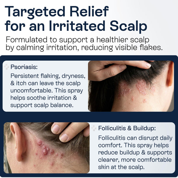 Pharmlitalia Psoriasis Shampoo for Dry & Itchy Scalp with Salicylic Acid 3% - Psoriasis Scalp Treatment for Eczema Relief, Seborrheic Dermatitis, Ringworm & Folliculitis