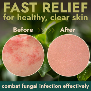 Terramed Just Think Comfort Treatment with Manuka Honey