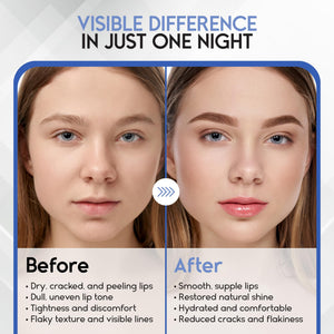 Lip Mask Overnight