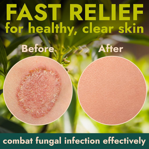 Antifungal Body Powder