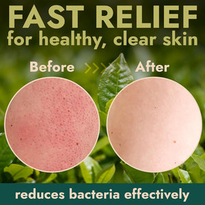 Antibacterial Body Scrub