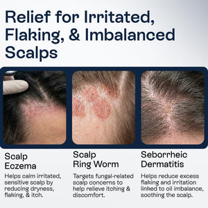 Pharmlitalia Psoriasis Shampoo for Dry & Itchy Scalp with Salicylic Acid 3% - Psoriasis Scalp Treatment for Eczema Relief, Seborrheic Dermatitis, Ringworm & Folliculitis