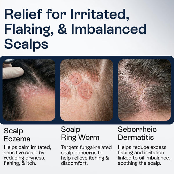 Pharmlitalia Psoriasis Shampoo for Dry & Itchy Scalp with Salicylic Acid 3% - Psoriasis Scalp Treatment for Eczema Relief, Seborrheic Dermatitis, Ringworm & Folliculitis
