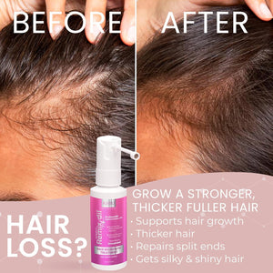 2% Minoxidil for Women Hair Regrowth Spray