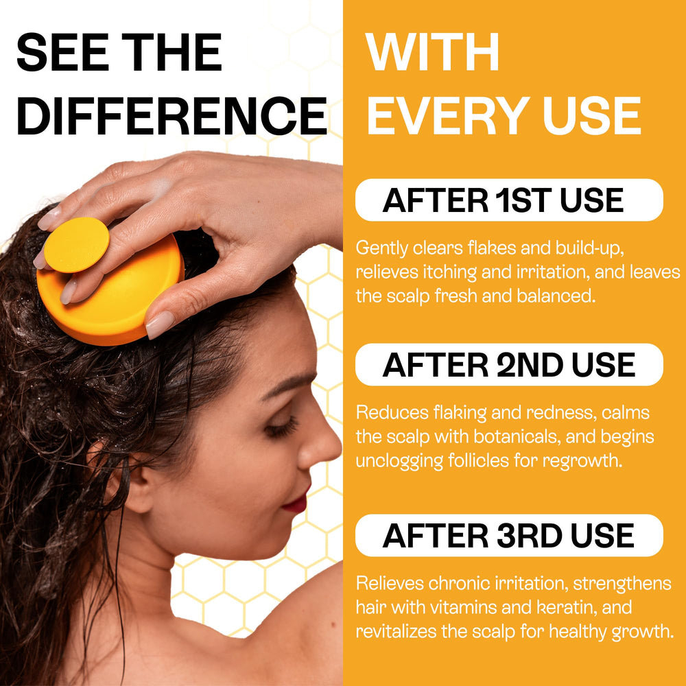 Psoriasis Shampoo for Dry & Itchy Scalp