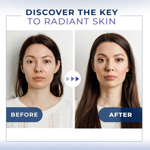 Anti Wrinkle Matrixyl 3000 Hyaluronic Acid Serum