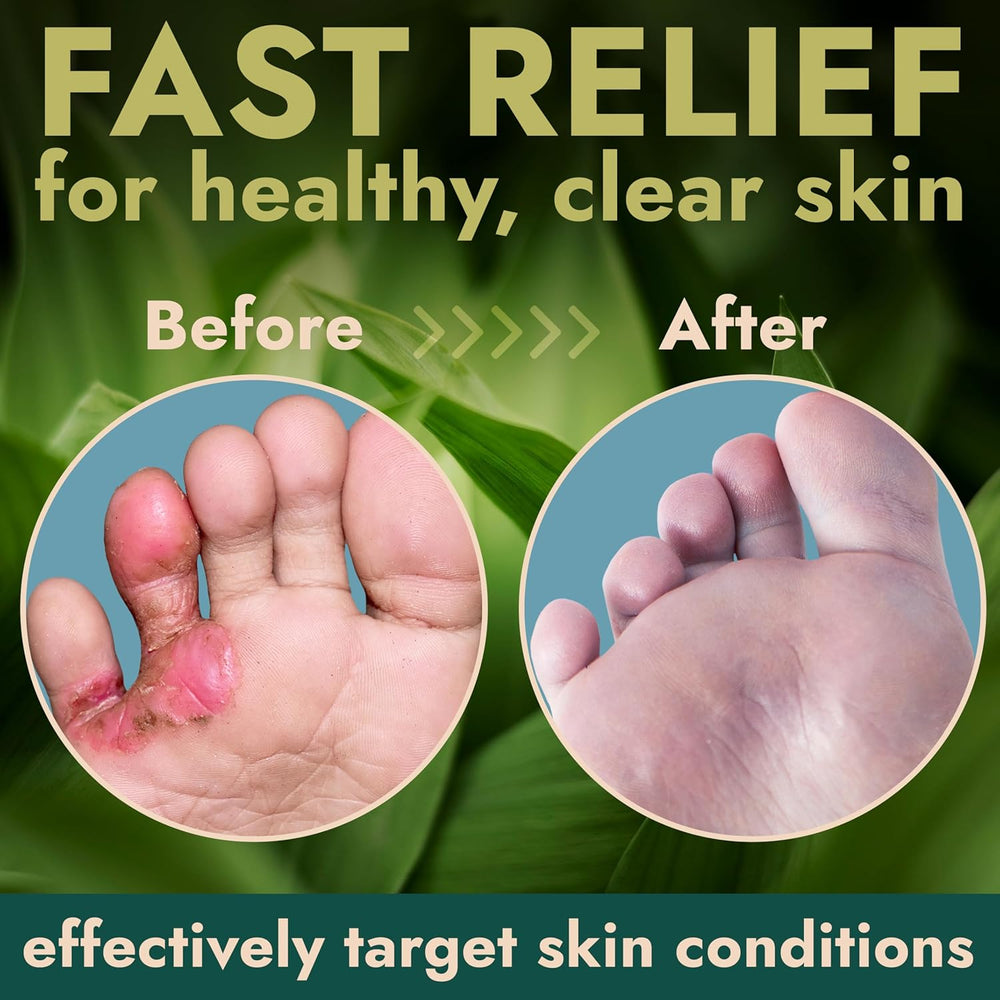 Tea Tree Oil Antifungal Foot Gel