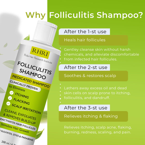 Folliculitis Shampoo | Antifungal Shampoo for Seborrheic Dermatitis, Scalp Psoriasis & Dandruff | Soothes Itchy, Dry Scalp | Cleanses, Exfoliates & Removes Build-Up | Reactivates Hair Follicles