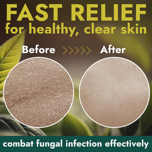 Antifungal Body Wash with Tea Tree Oil