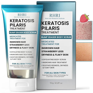 Keratosis Pilaris Treatment