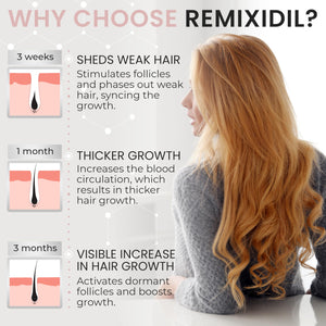 2% Minoxidil for Women Hair Regrowth Spray