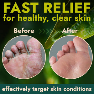Foot Cream with Tea Tree Oil