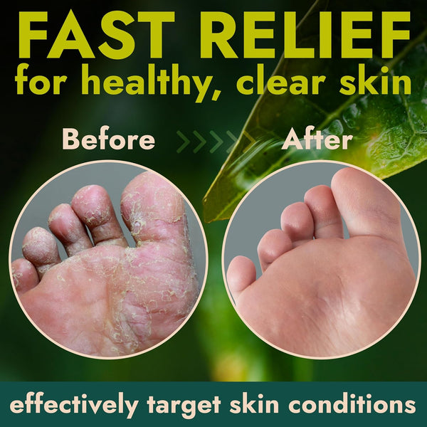 Foot Cream with Tea Tree Oil