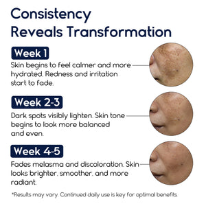 Melasma and Initmate Cream