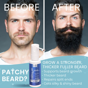 5% Minoxidil for Men Hair Regrowth Spray