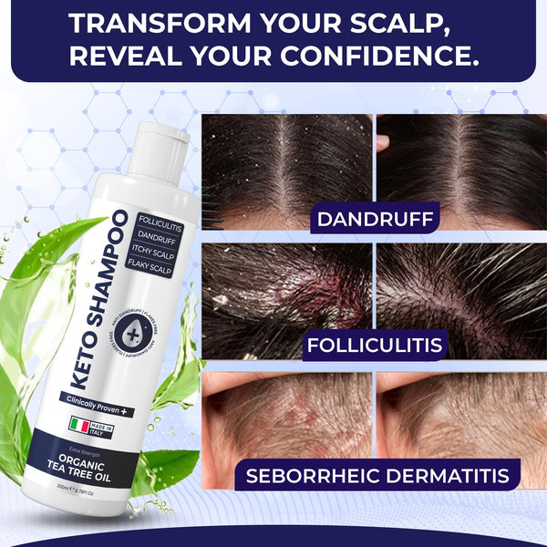 Pharmlitalia Scalp Psoriasis Shampoo